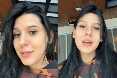 Ana Castela mostra processo de tratamento para espinhas e desabafa: 'Emocional'