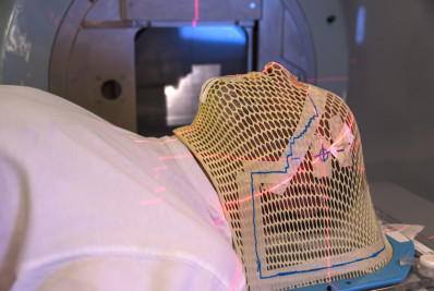 Câncer cerebral: a importância do diagnóstico precoce