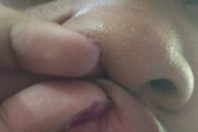 Mãe denuncia que filha de 14 anos teve dente quebrado ao ser agredida em colégio em São Gonçalo