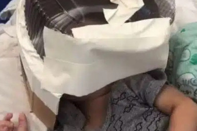 Hospital improvisa máscara de oxigênio com embalagem de bolo para bebê