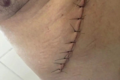 Idoso vai a hospital para operar hemorroida e sai da unidade sem vesícula em SP