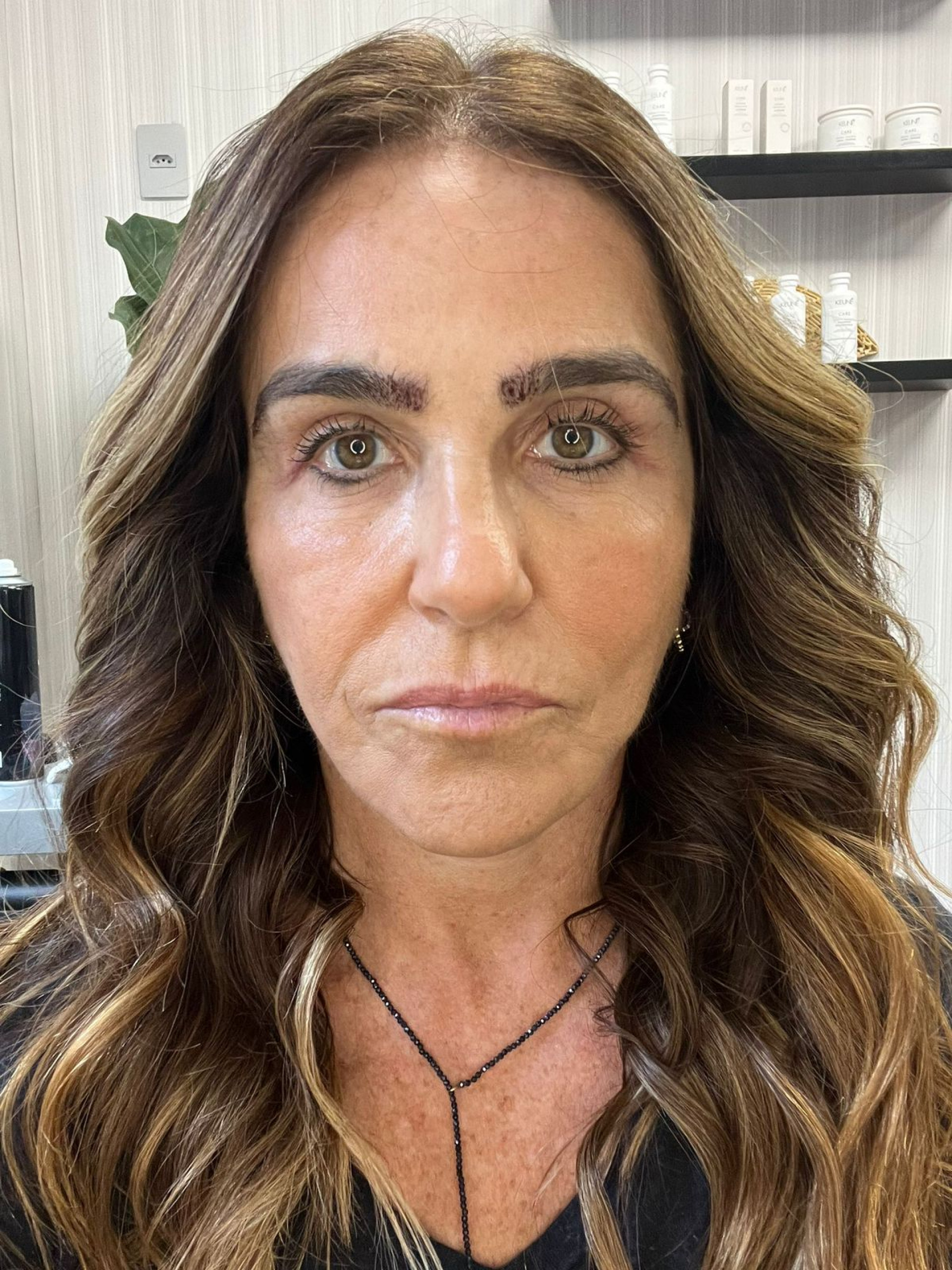 Atriz Monique Curi mostra resultado do seu transplante de sobrancelhas - Divulgação 