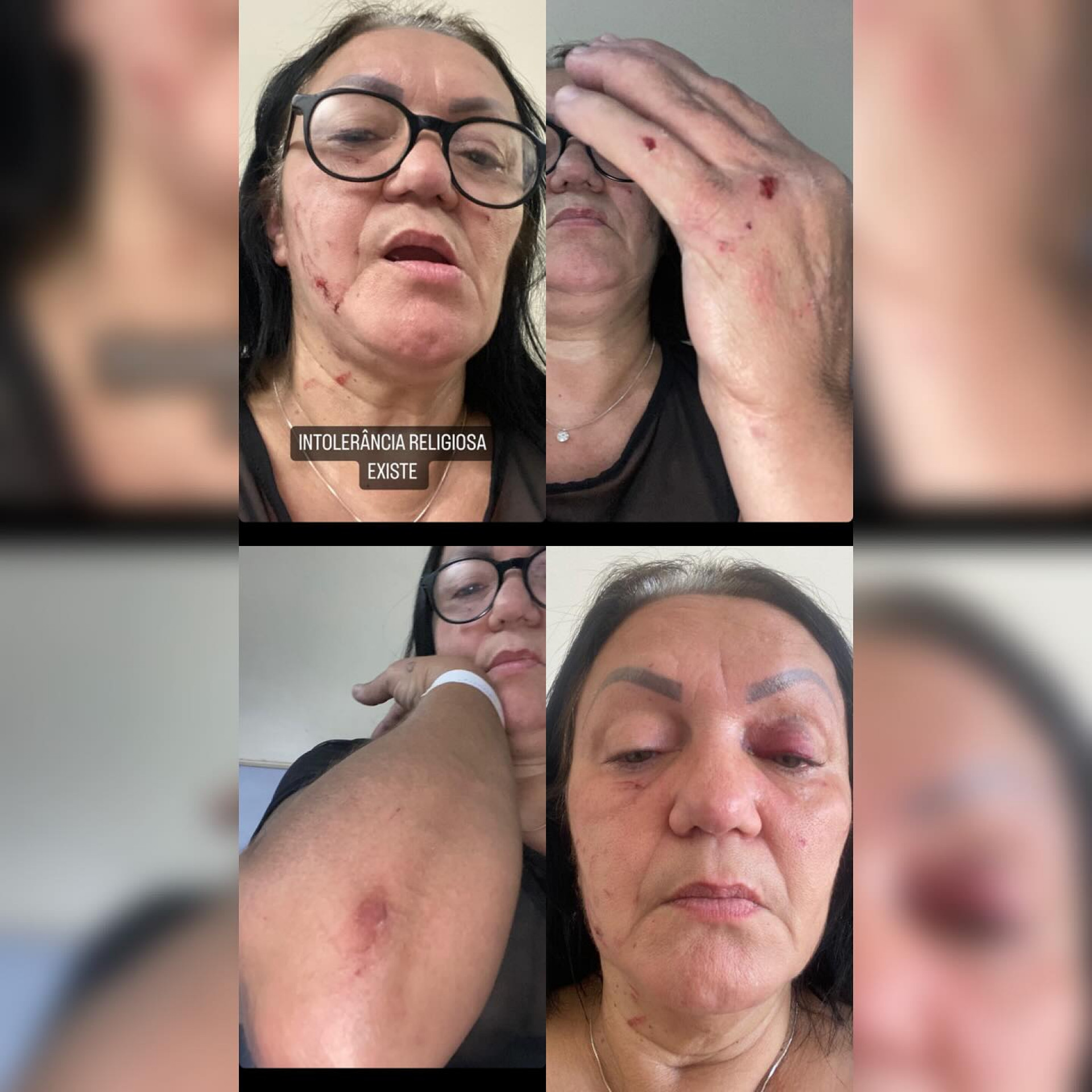 Mãe e filha denunciam vizinha por intolerância religiosa e agressão no Engenho de Dentro