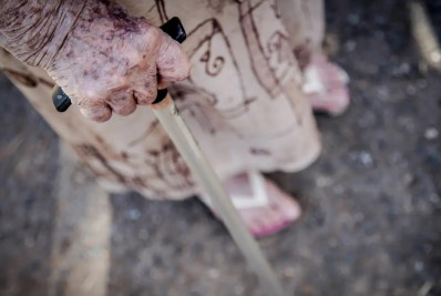 Ortopedistas alertam para risco de queda de idosos; saiba como evitar