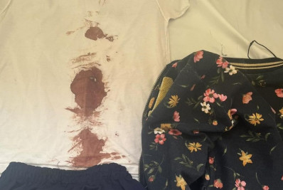 Menina atingida por bala perdida no Catumbi recebe alta após uma semana internada