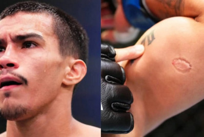 Brasileiro recebe 'gancho' após morder adversário e ser demitido pelo UFC