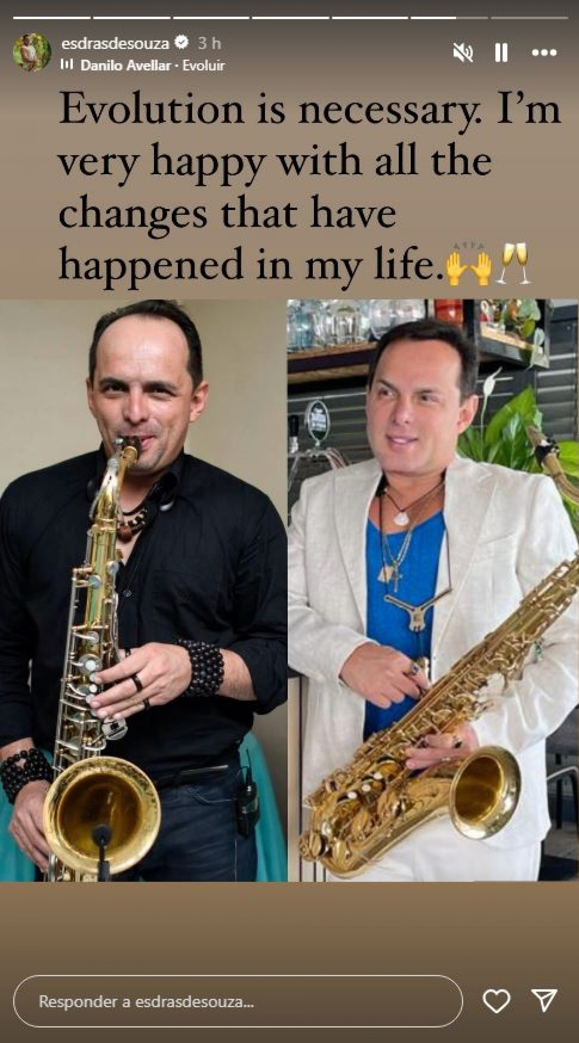 Marido de Gretchen compartilha antes e depois de procedimentos estéticos - Reprodução / Instagram