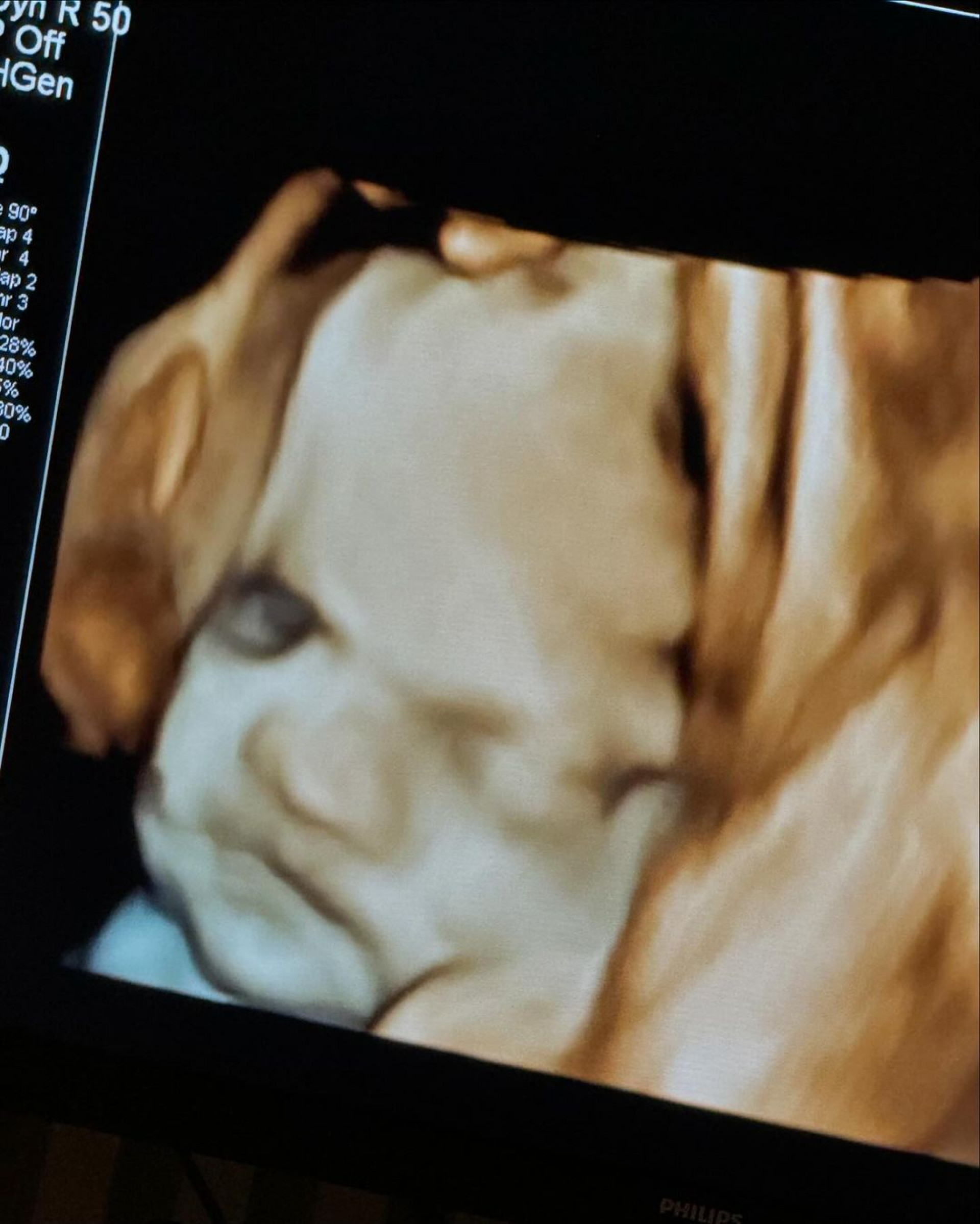 Virginia Fonseca mostra ultrassom do terceiro filho - Reprodução