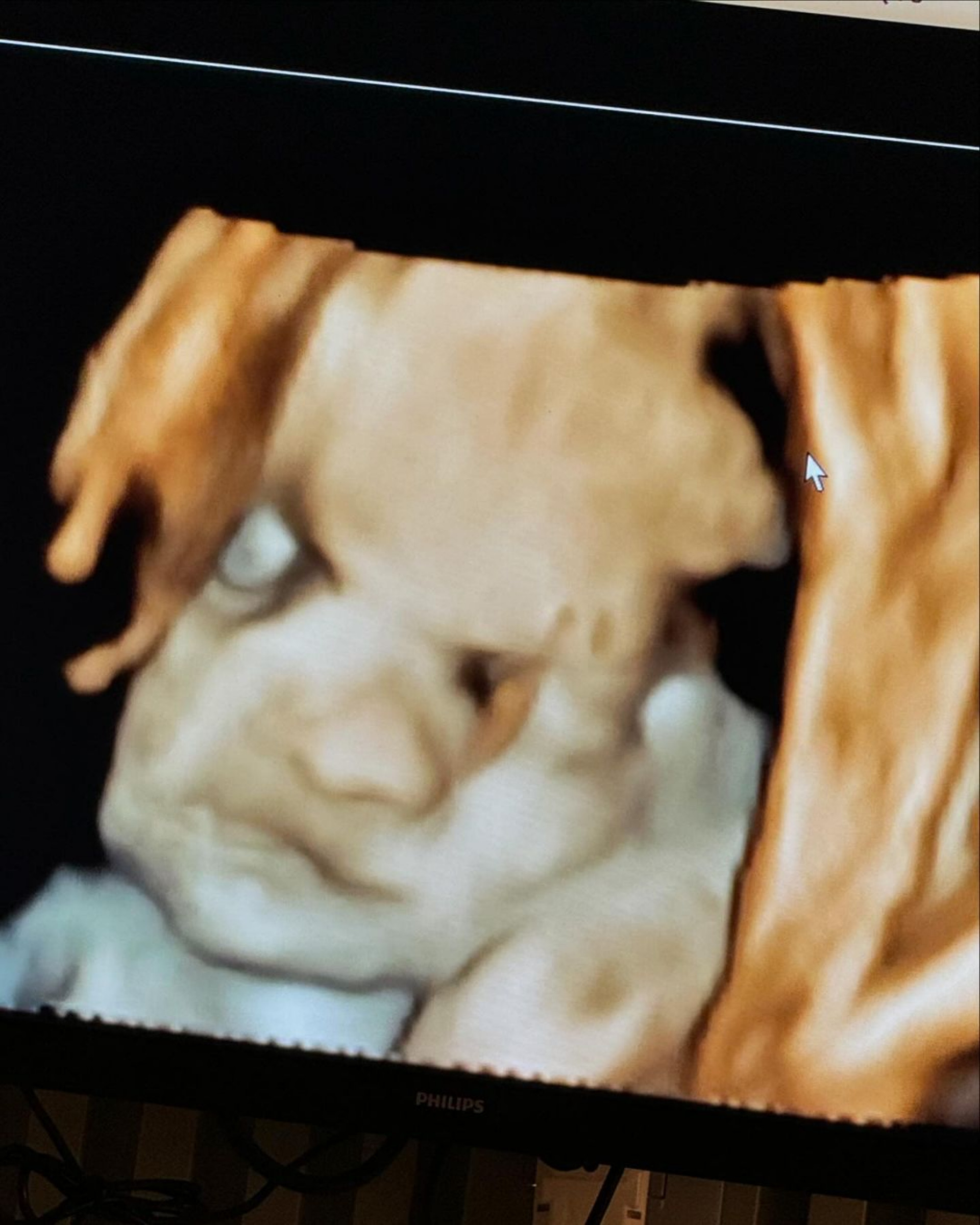 Virginia Fonseca mostra ultrassom do terceiro filho - Reprodução