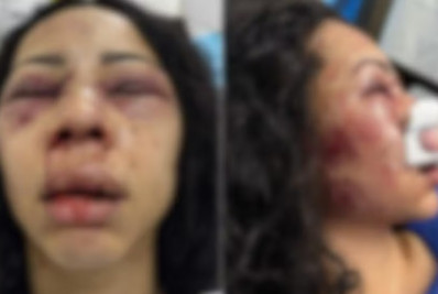 Chile: turista brasileira é espancada durante assalto