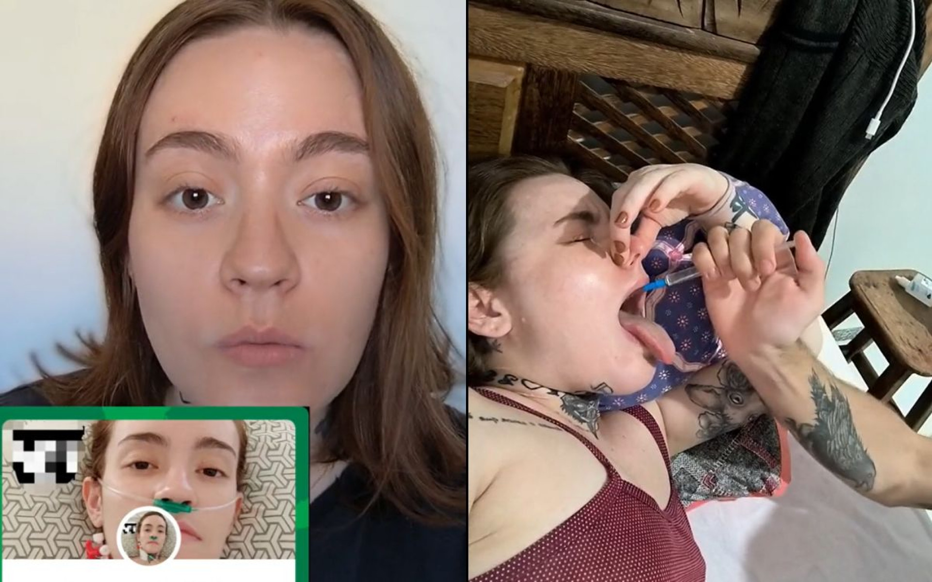 Carolina convive com a neuralgia do trigêmeo, considerada a 'pior dor do mundo' - Reprodução / TikTok