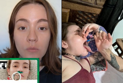 Influenciadora que tem neuralgia do trigêmeo abre vaquinha para fazer eutanásia no exterior