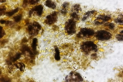 Autismo pode ser diagnosticado com amostra de fezes, apontam cientistas