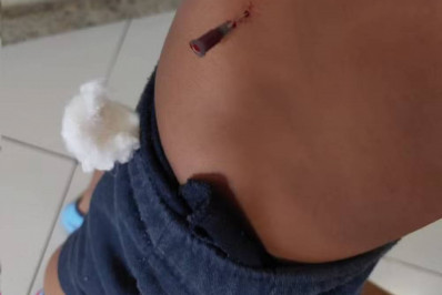 Mãe denuncia agulha esquecida em criança após atendimento em hospital de Niterói