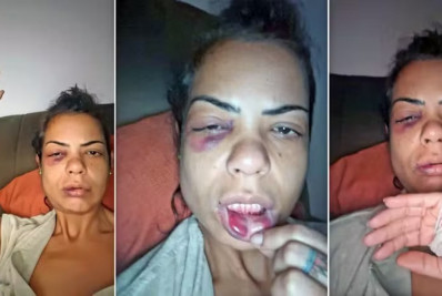 Professora é agredida por casal após briga de trânsito na Zona Norte