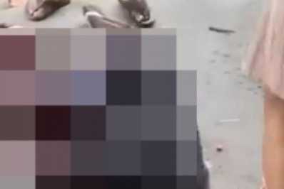 Em estado gravíssimo, menino de 6 anos baleado em Caxias passa por cirurgia