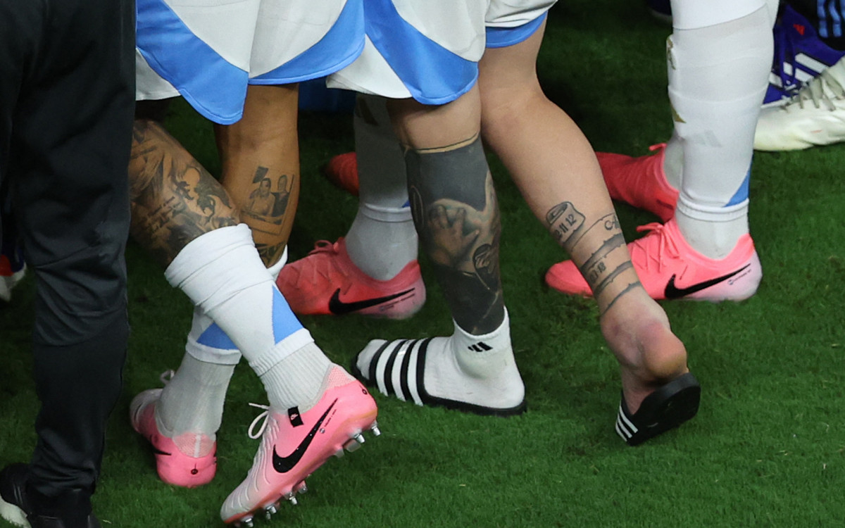 Tornozelo direito de Messi, no momento da substituição