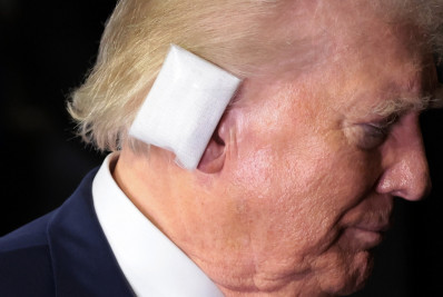 Especialista detalha o poder devastador do disparo que quase vitimou Trump