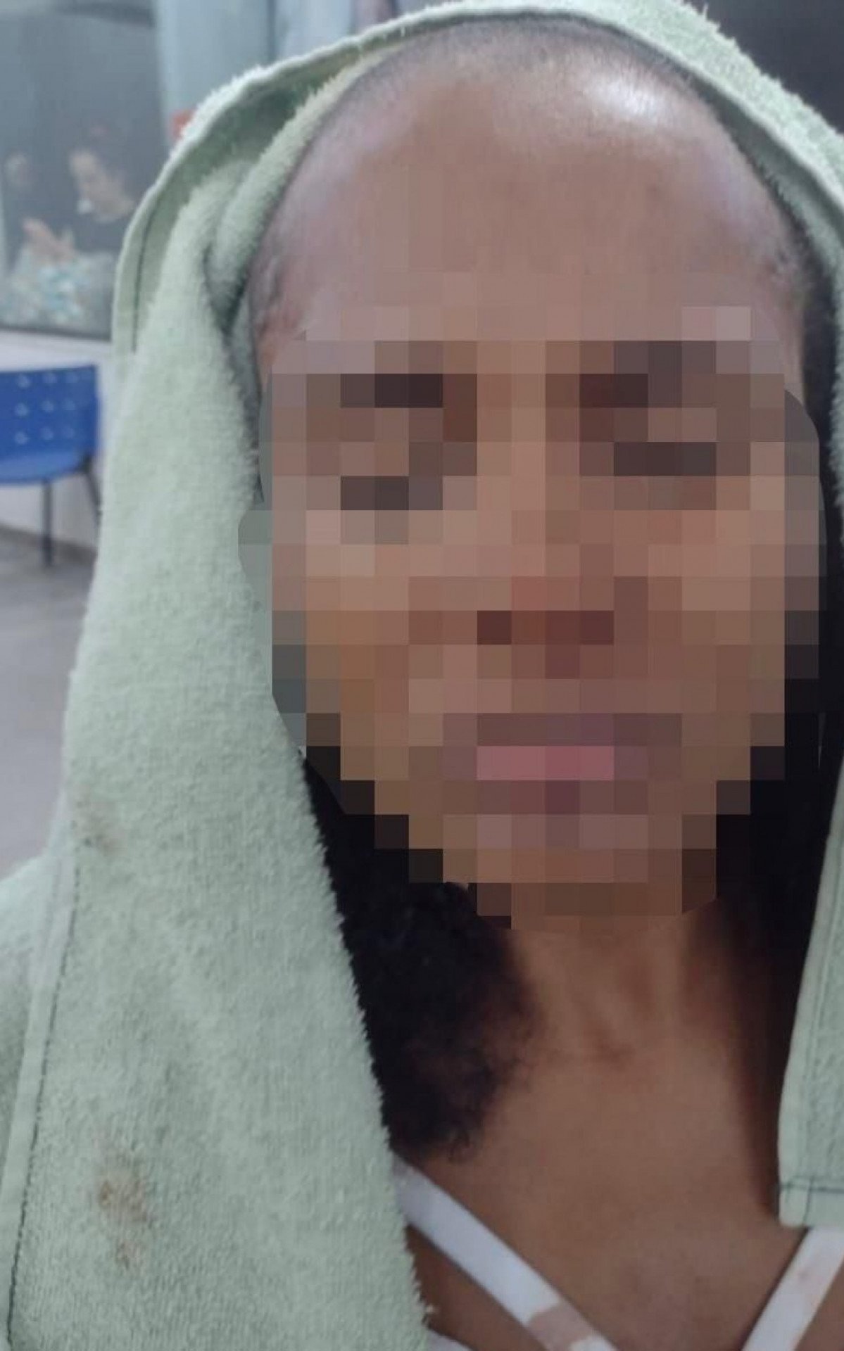 A vítima foi obrigada a raspar o próprio cabelo após ser agredida pelo companheiro - Divulgação