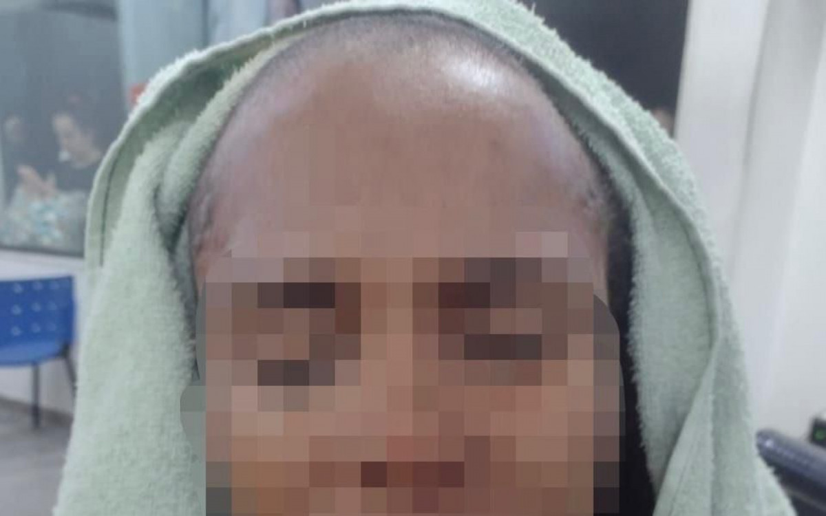 A vítima foi obrigada a raspar o próprio cabelo após ser agredida pelo companheiro