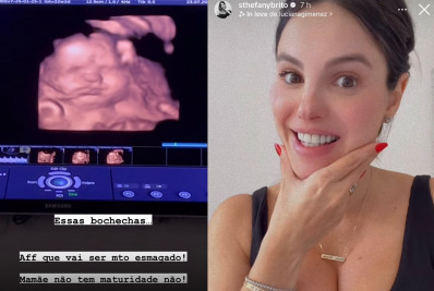Sthefany Brito mostra ultrassom do filho e brinca: 'Bochecha? Só temos'