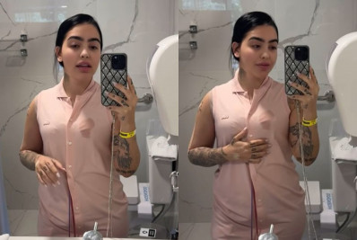 MC Mirella passa por cirurgia plástica e revela procedimentos realizados