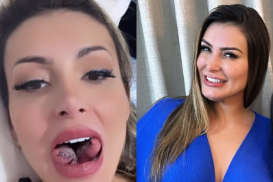 Andressa Urach choca web ao fazer cirurgia para dividir a língua em duas: 'Loucura'
