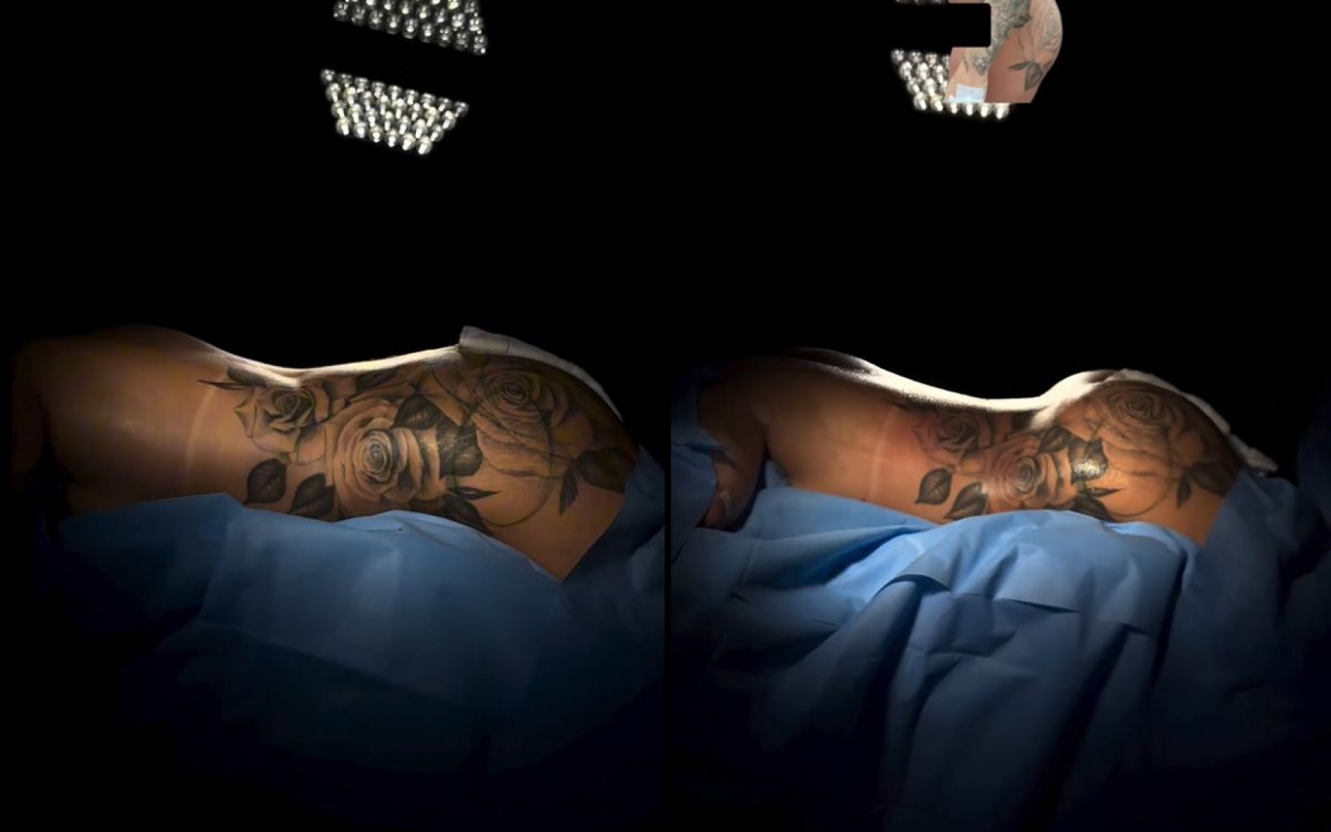 Antes e depois das cirurgias plásticas de MC Mirella - Reprodução / Instagram