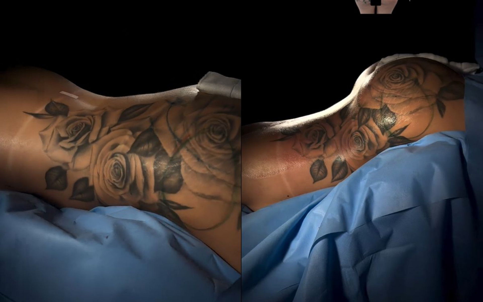 Antes e depois das cirurgias plásticas de MC Mirella - Reprodução / Instagram