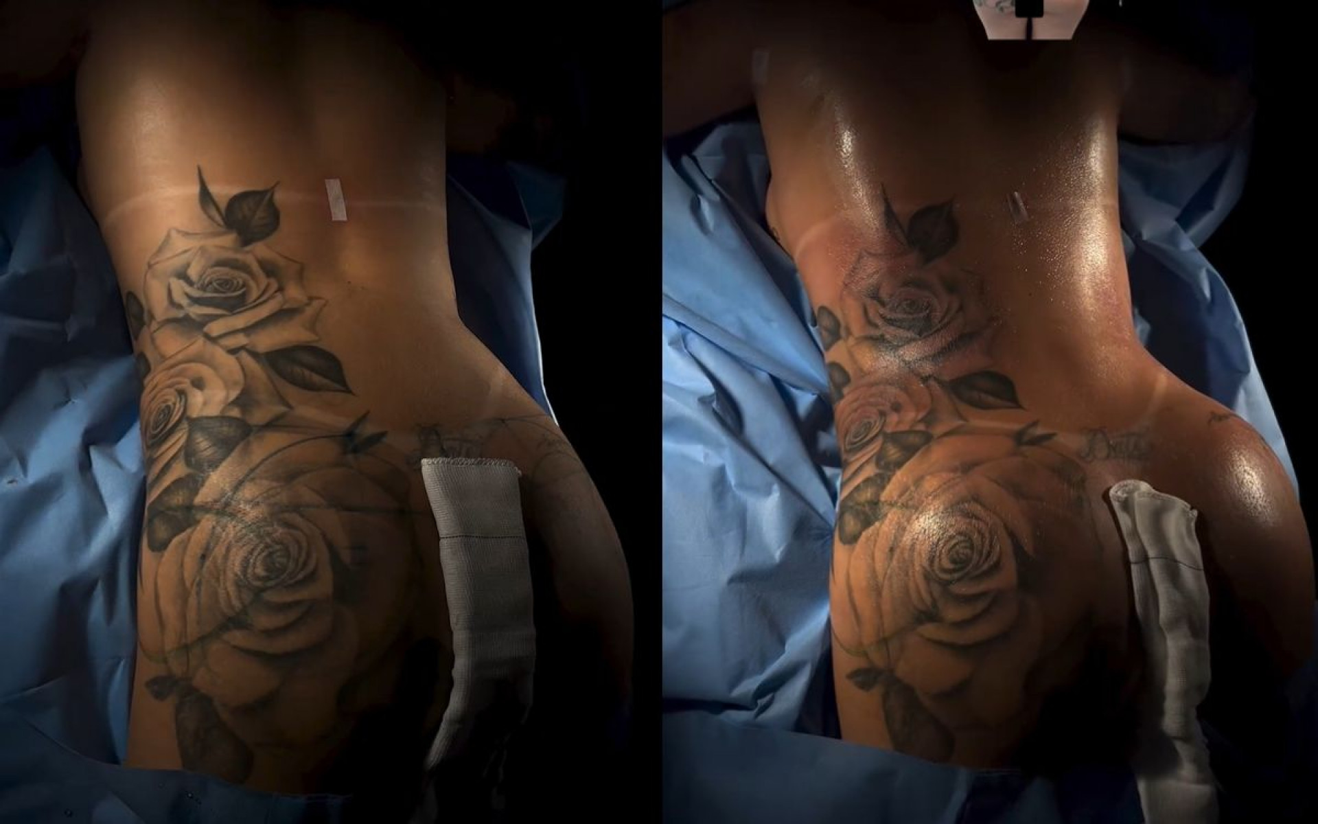 Antes e depois das cirurgias plásticas de MC Mirella - Reprodução / Instagram