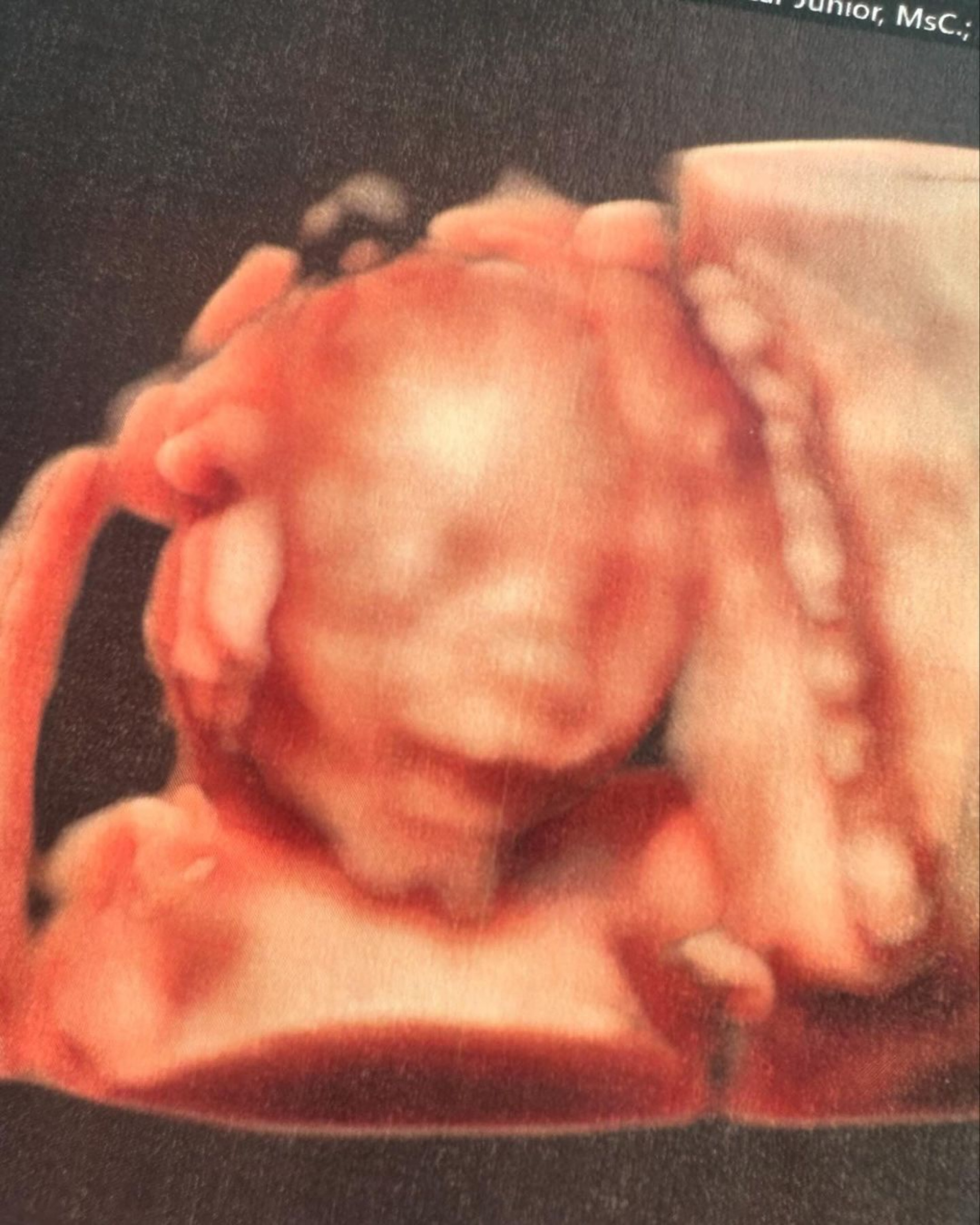 Zezé Di Camargo acompanha ultrassonografia de Graciela Lacerda  - Reprodução / Instagram