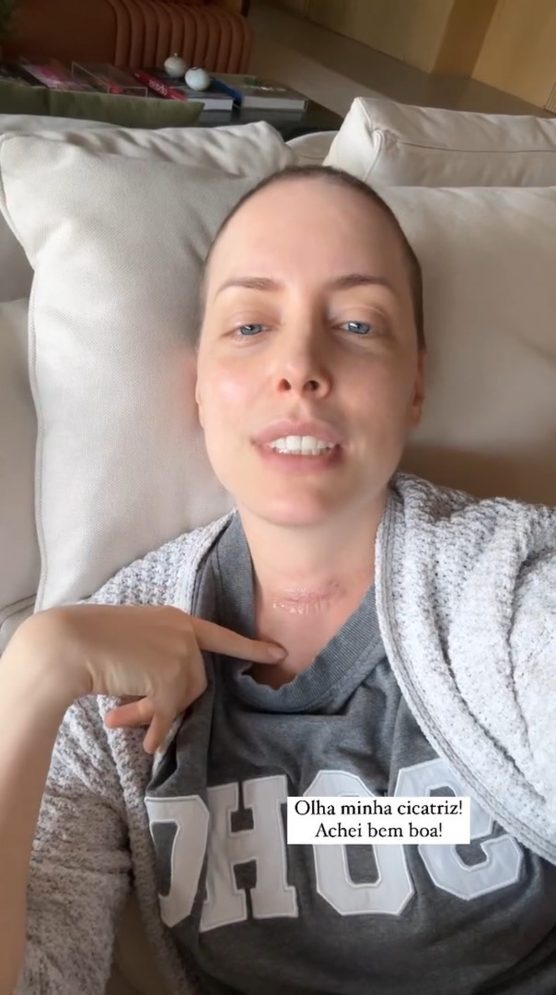 Fabiana Justus mostra como ficou a cicatriz no pescoço  - Reprodução / Instagram