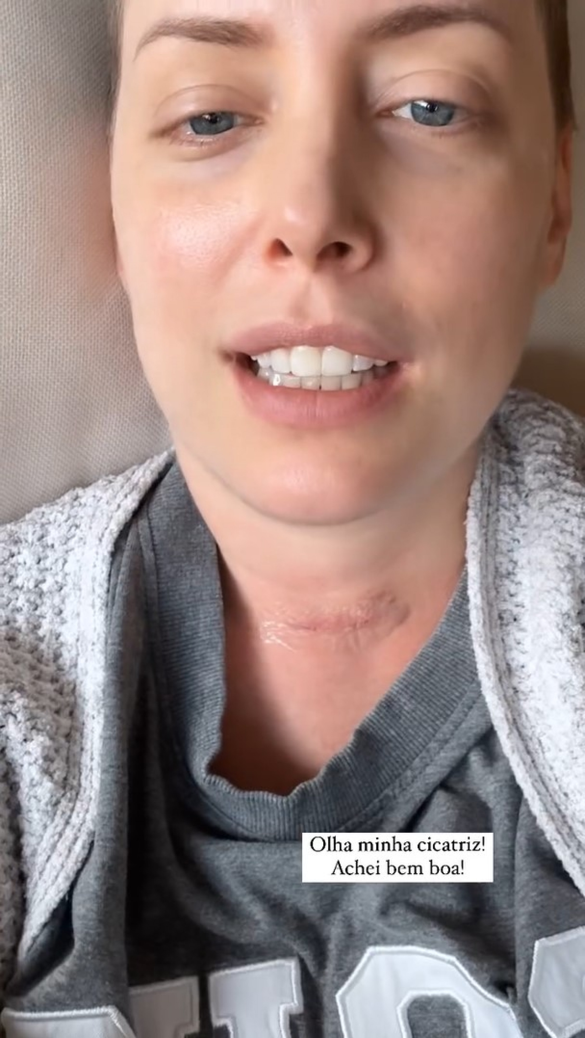 Fabiana Justus mostra como ficou a cicatriz no pescoço  - Reprodução / Instagram