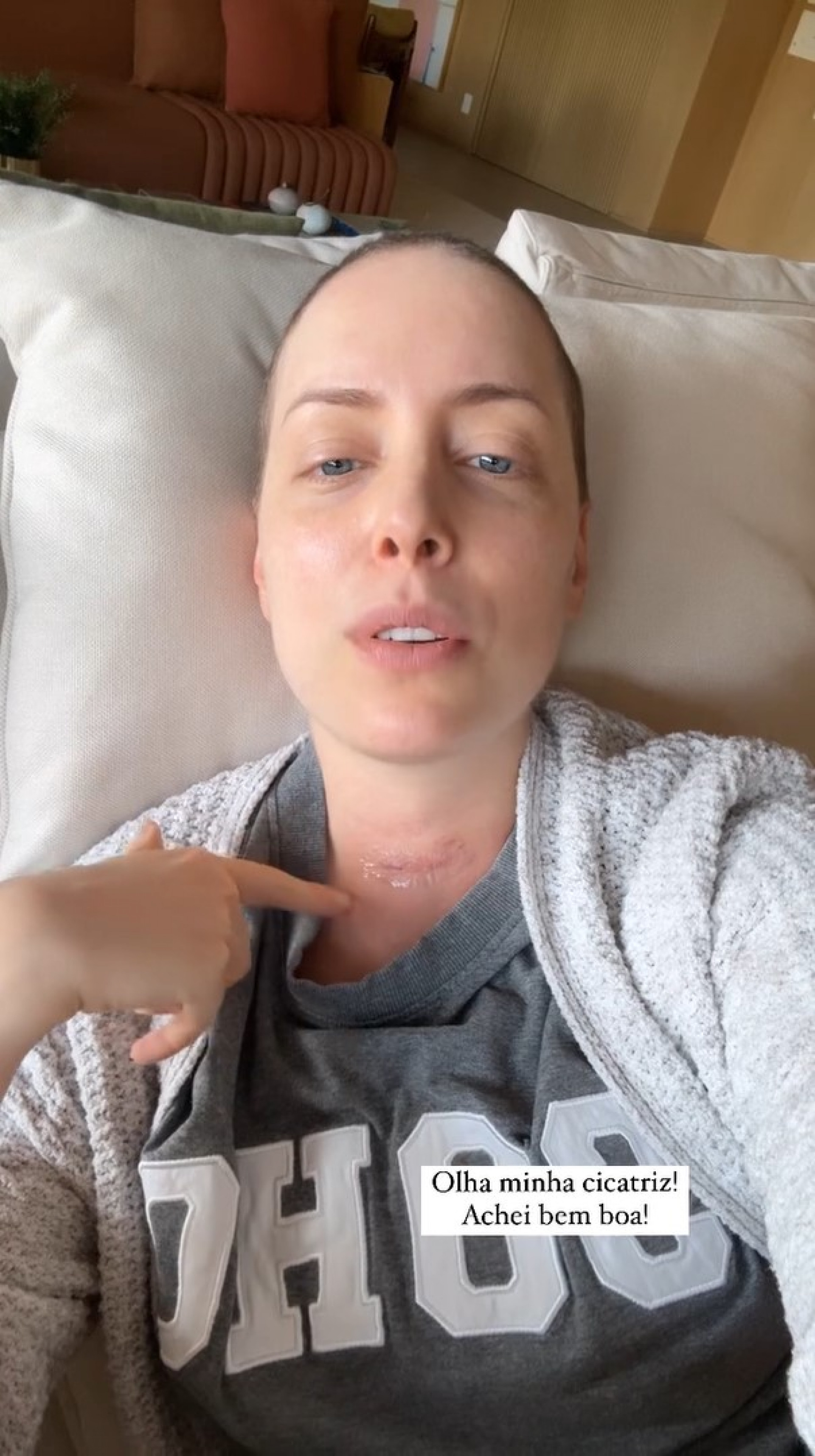 Fabiana Justus mostra como ficou a cicatriz no pescoço  - Reprodução / Instagram