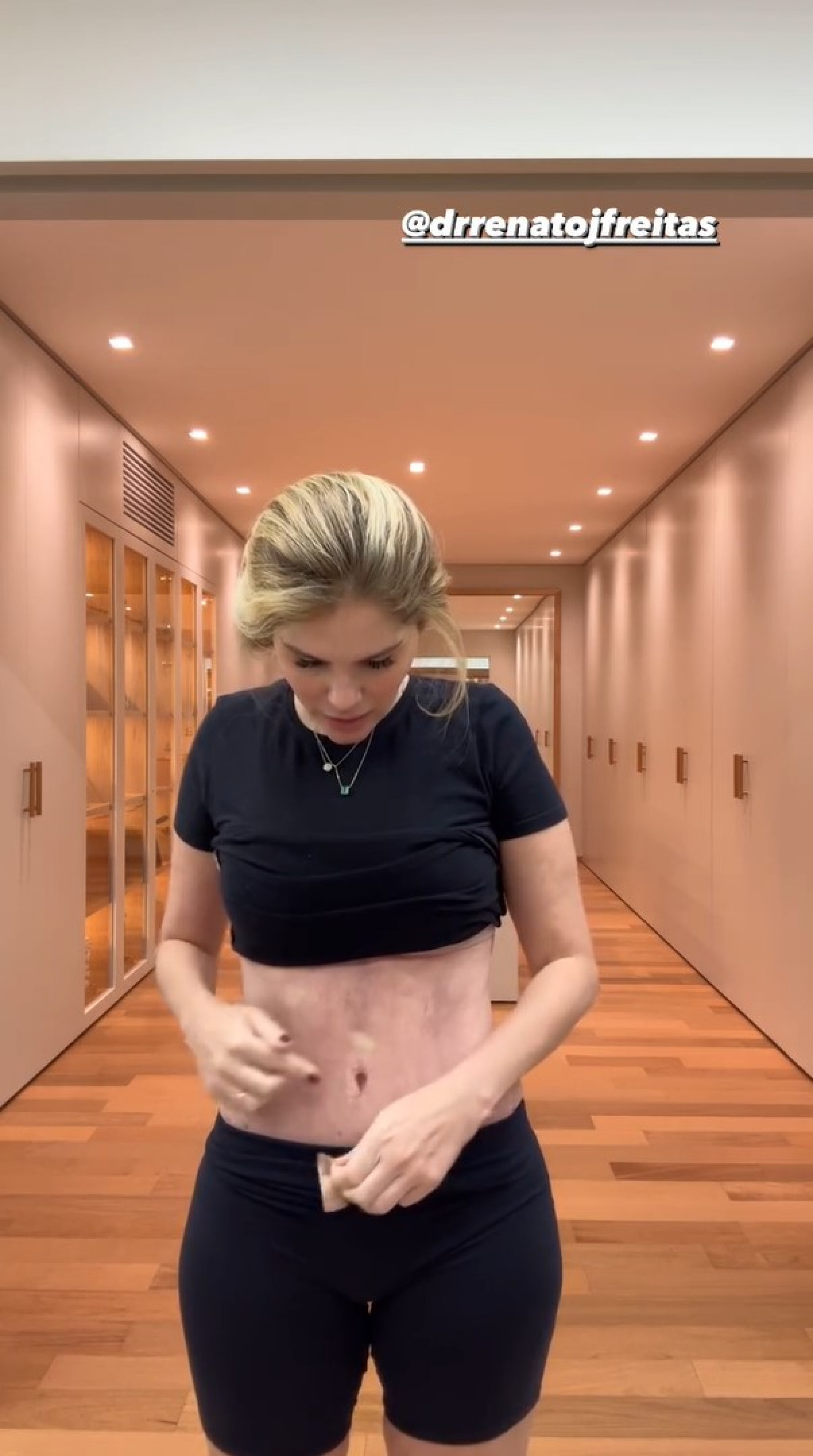 Bárbara Evans mostra barriga após cirurgia plástica - Reprodução / Instagram
