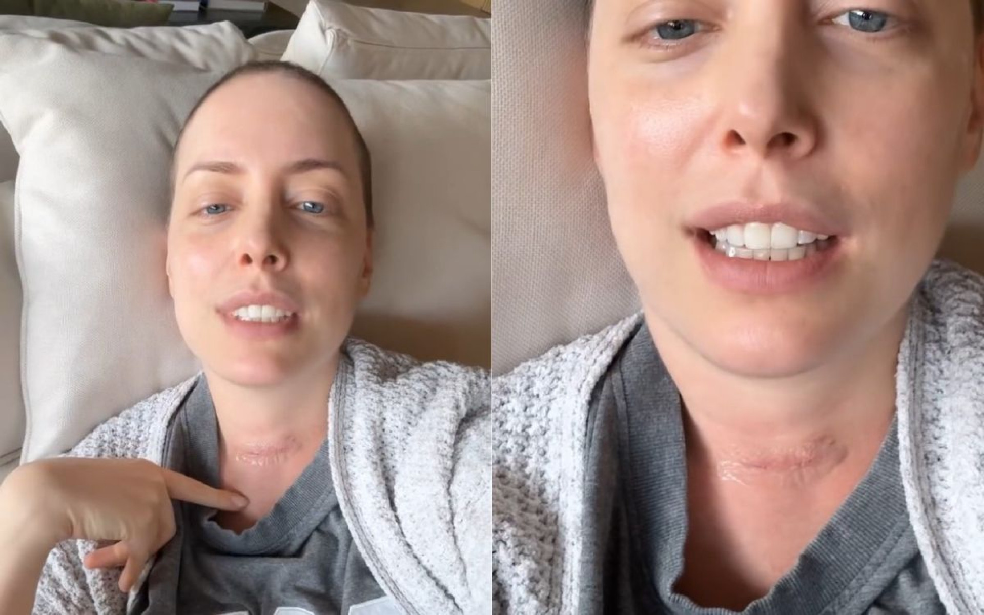 Fabiana Justus mostra como ficou a cicatriz no pescoço  - Reprodução / Instagram