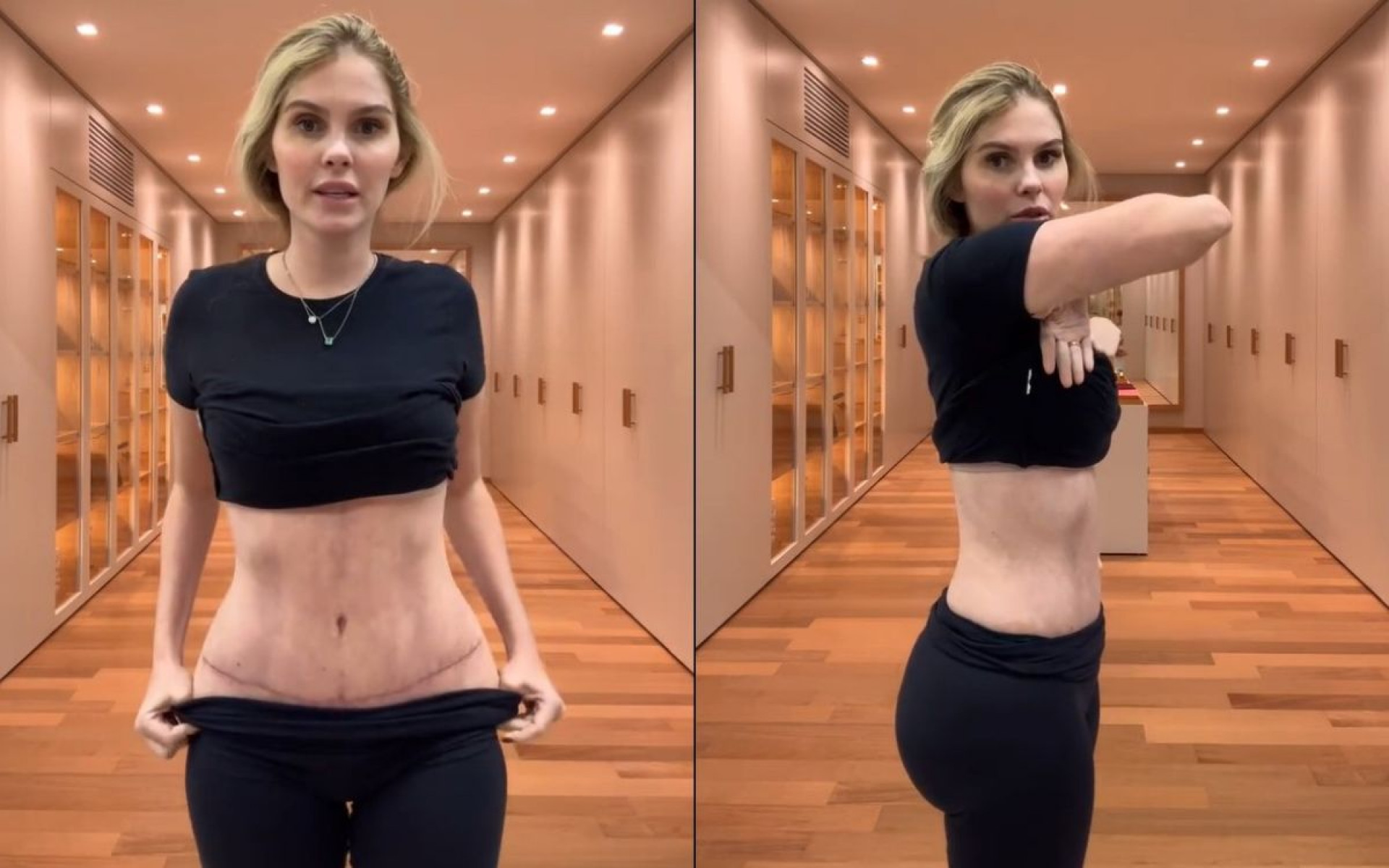 Bárbara Evans mostra barriga após cirurgia plástica - Reprodução / Instagram