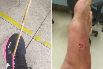 Mulher é atingida por 'flecha' enquanto caminhava em rua de Belo Horizonte