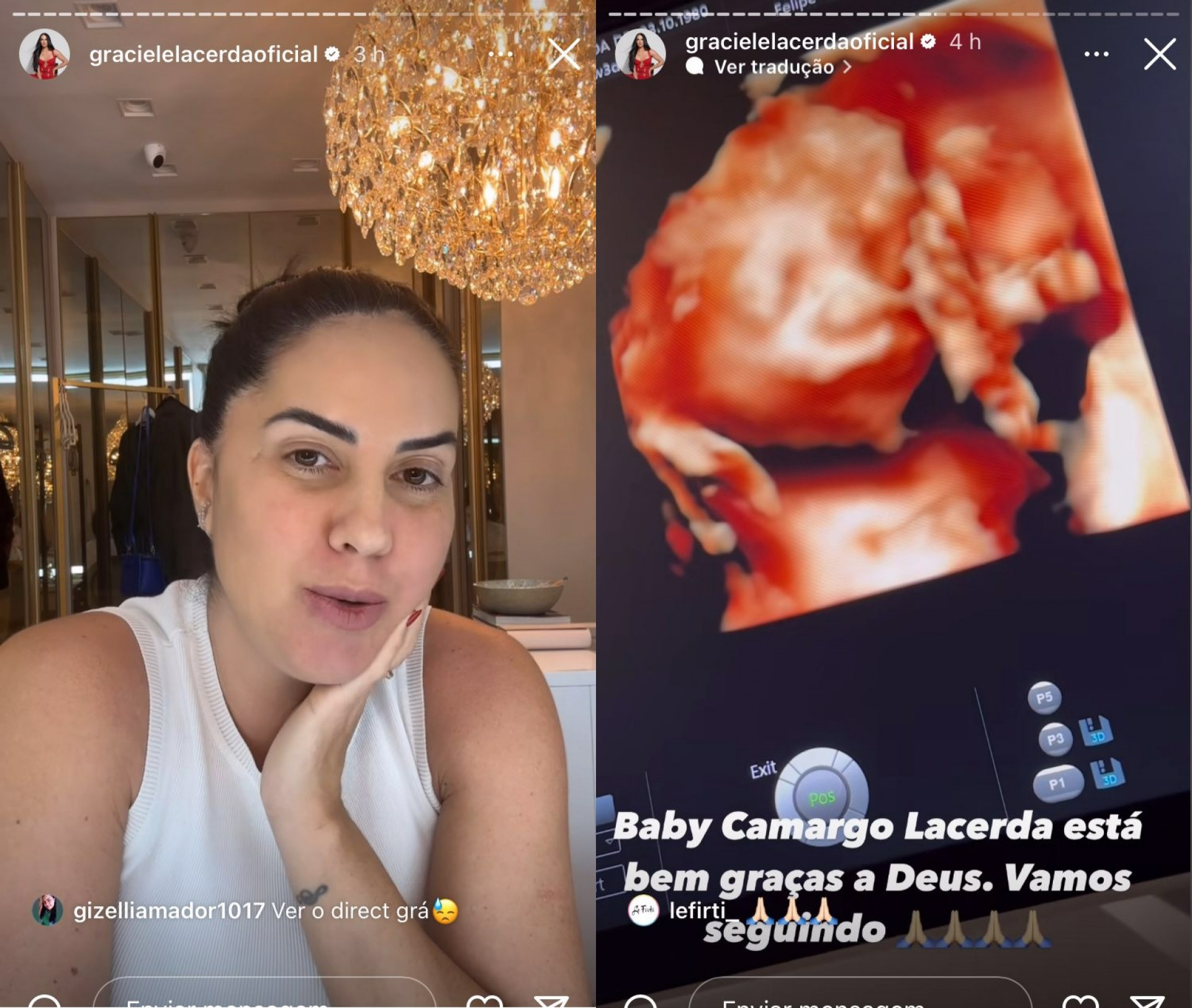 Graciele Lacerda, grávida de Zezé di Camargo, compartilha ultrassom 3D - Reprodução / Instagram