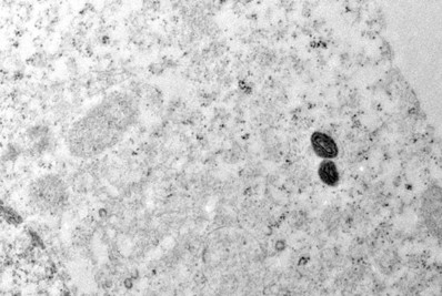 Argentina descarta mpox em tripulante de navio que saiu do Brasil