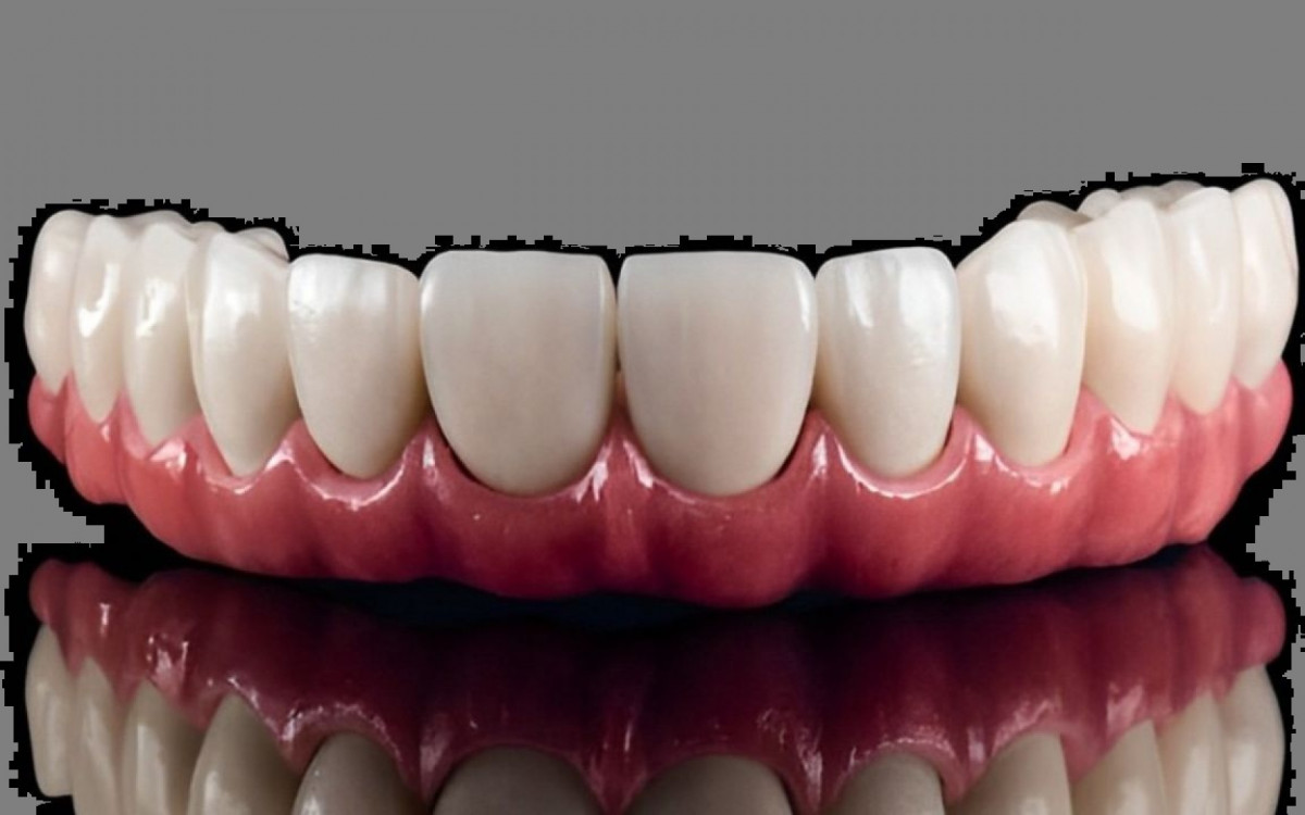 O relatório aponta um dado muito bizarro: 10% dos hotéis relataram ter encontrado dentaduras deixadas pelos hóspedes. 