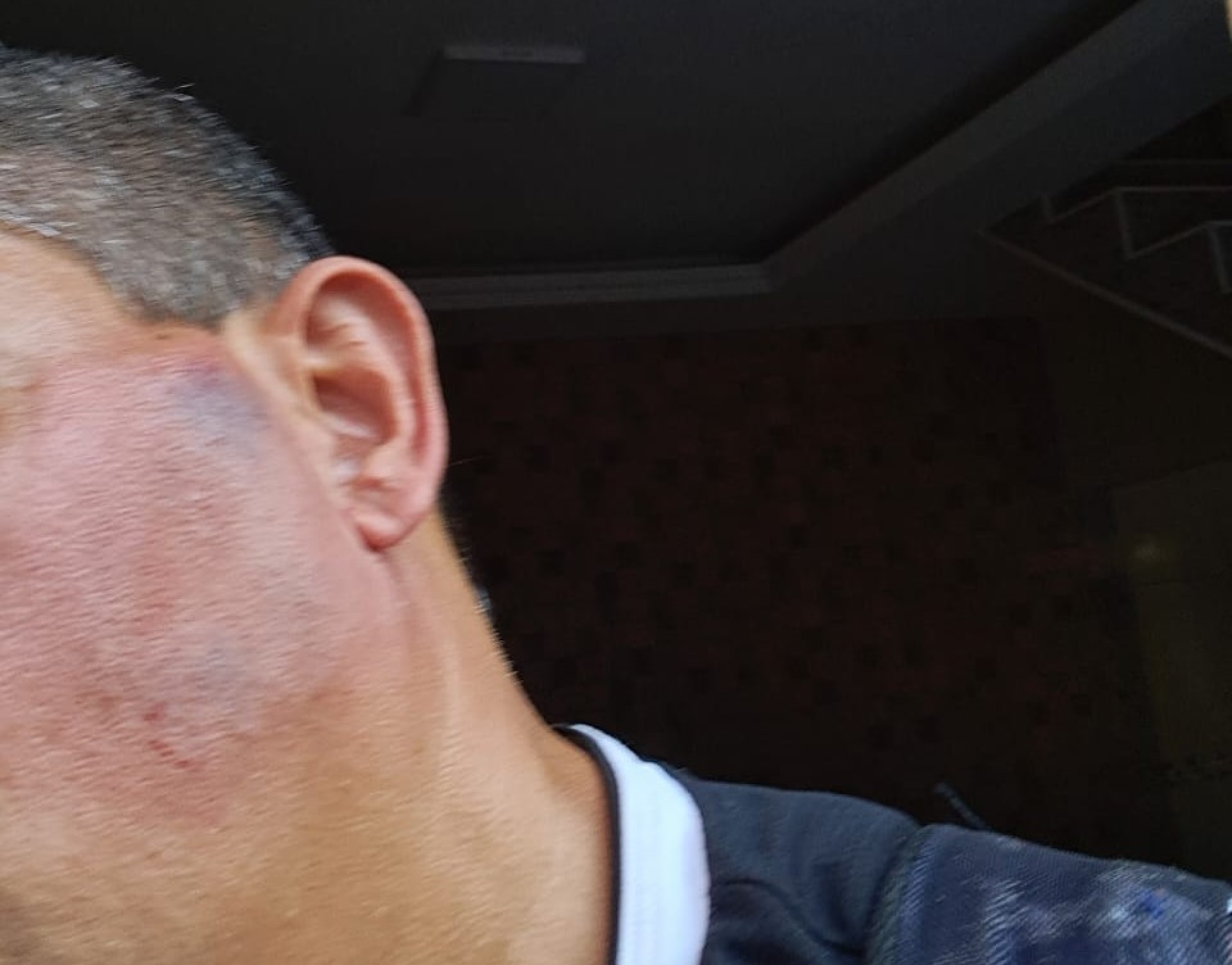 Márcio Nascimento foi atingido por uma pedra enquanto voltava do trabalho em Sepetiba - Reprodução / Redes Sociais