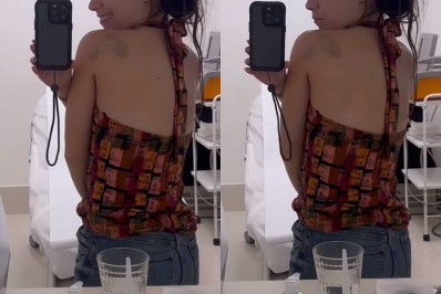 Na reta final de 'Família é Tudo', Daphne Bozaski decide remover tatuagem feita aos 16 anos