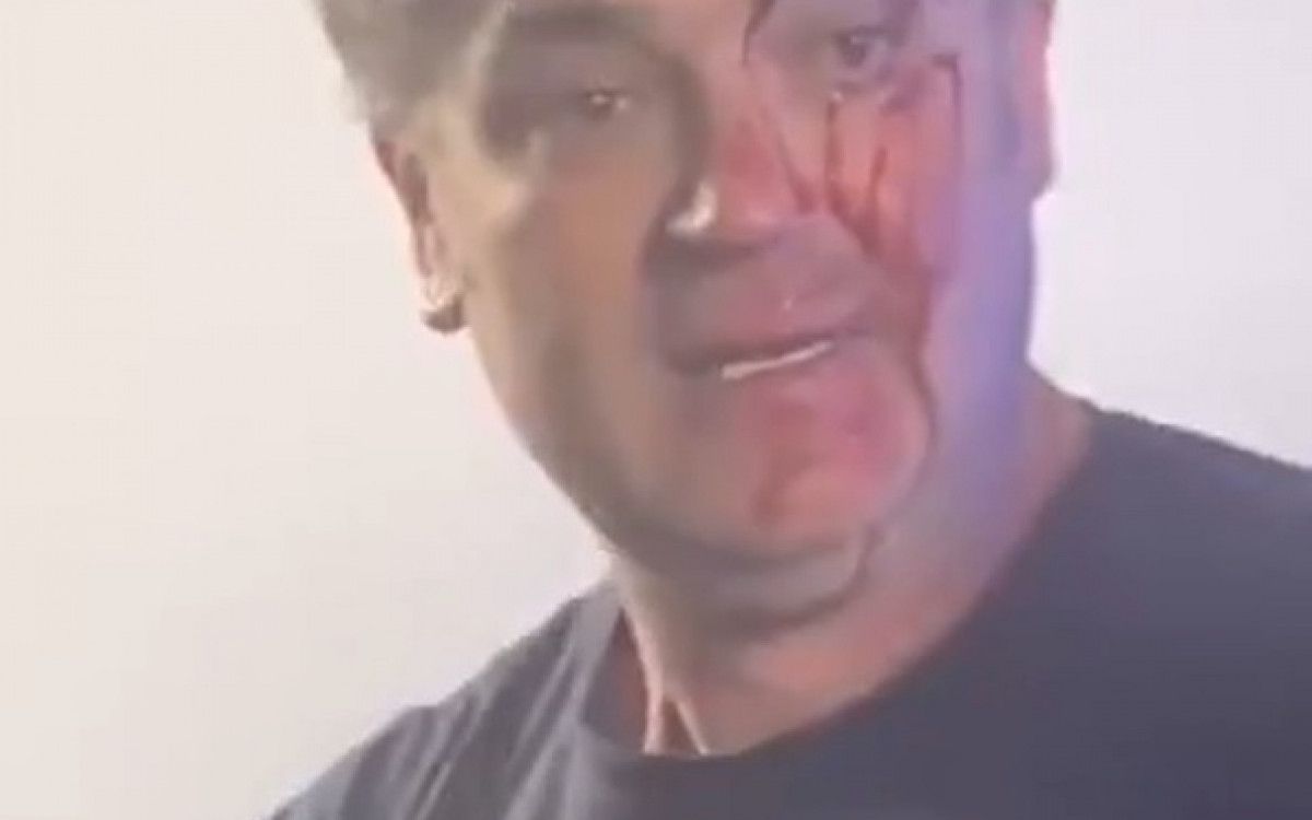 Duda Lima precisou levar pontos após agressão