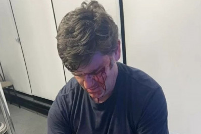 Marqueteiro de Nunes sobre soco de aliado de Marçal: 'Violência pelas costas'