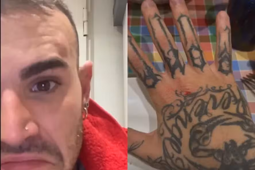 Ginasta sofre tentativa de roubo e briga com ladrão: 'Levou uns socos'