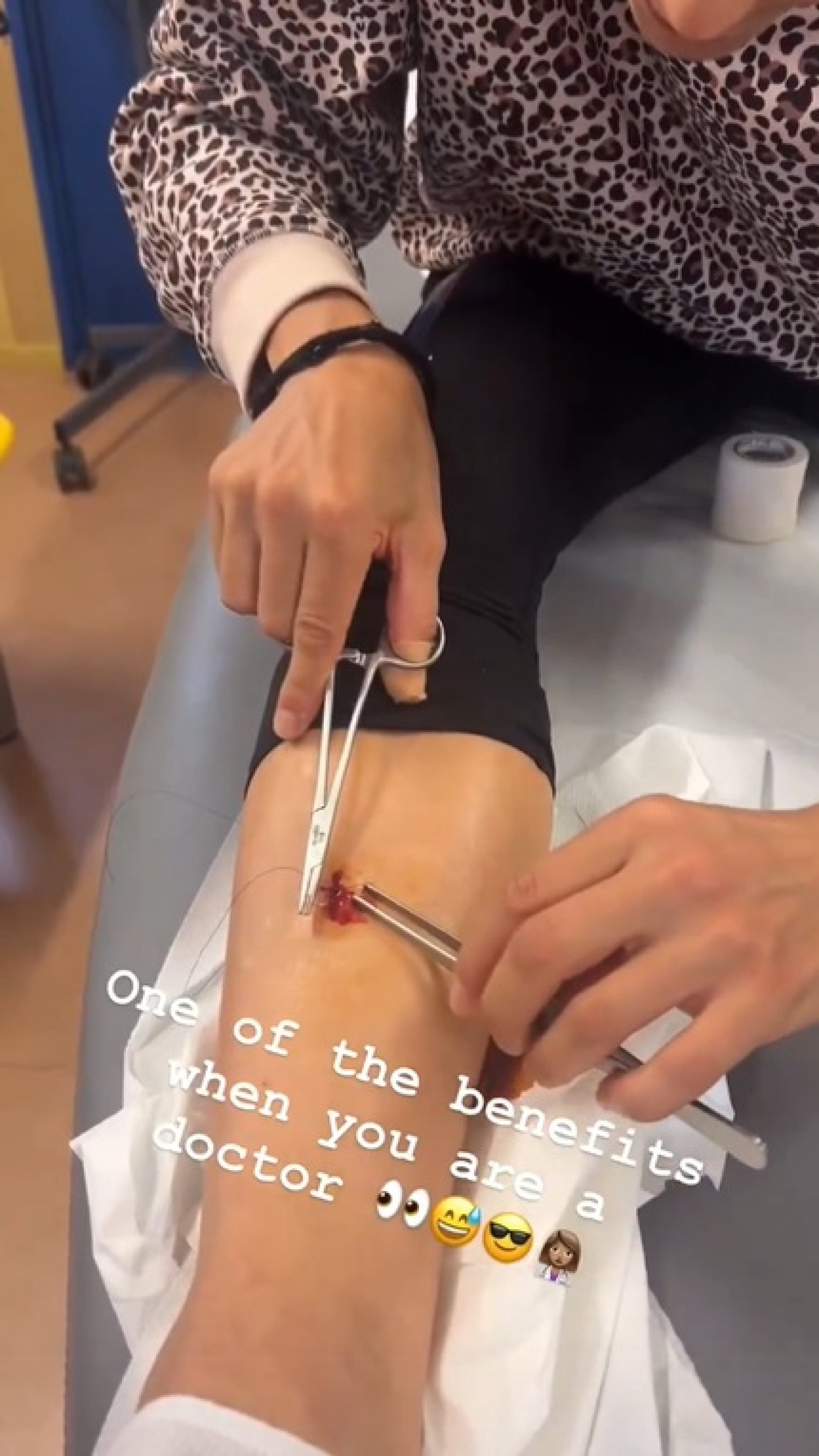 Atacante do Milan saturou sua própria perna após sofrer lesão