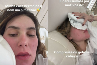 Virginia Fonseca reclama de dores após início de tratamento para enxaqueca