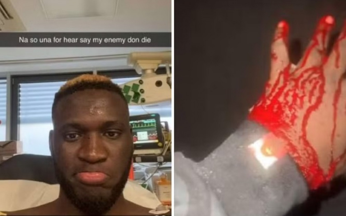 Boniface ficou com a mão ensanguentada após acidente