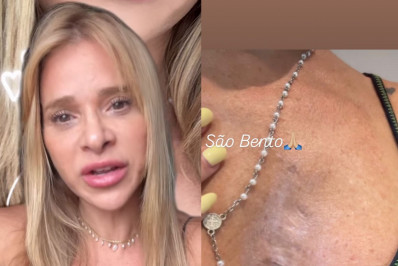 Dany Bananinha mostra cicatriz após retirar nódulo